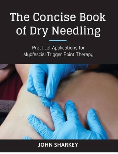 Бумажная книга «The Concise Book of Dry Needling: Practical Applications for Myofascial Trigger Point Therapy», автор Джон Шарки - фото №1