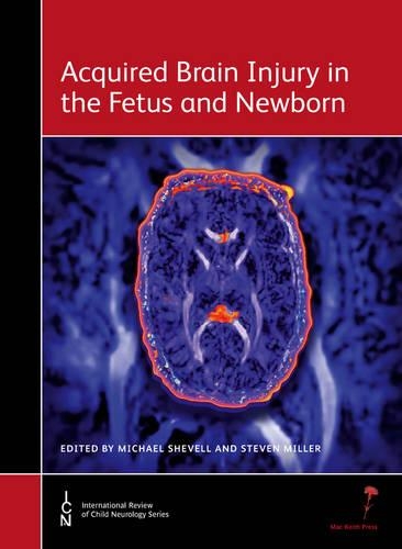 Паперова книга «Acquired Brain Injury in the Fetus and Newborn», авторів Майкл Шевелл, Стівен Міллер - фото №1