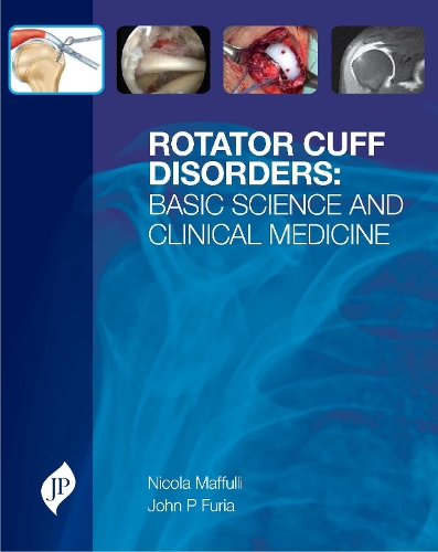 Бумажная книга «Rotator Cuff Disorders: Basic Science and Clinical Medicine», авторов Джон П. Фурия, Никола Маффулли - фото №1