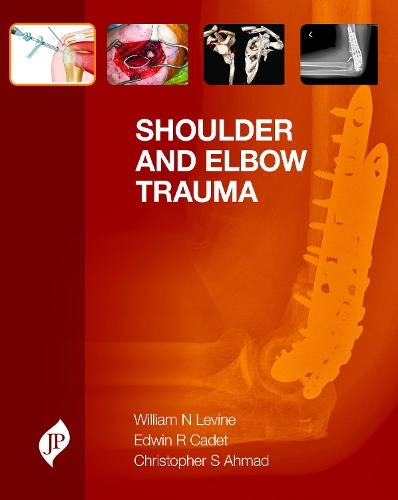 Паперова книга «Shoulder and Elbow Trauma», автор Вільям Н. Левін - фото №1