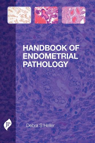 Паперова книга «Handbook of Endometrial Pathology», автор Дебра С. Геллер - фото №1