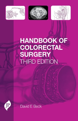 Бумажная книга «Handbook of Colorectal Surgery: Third Edition», автор Дэвид Бек - фото №1