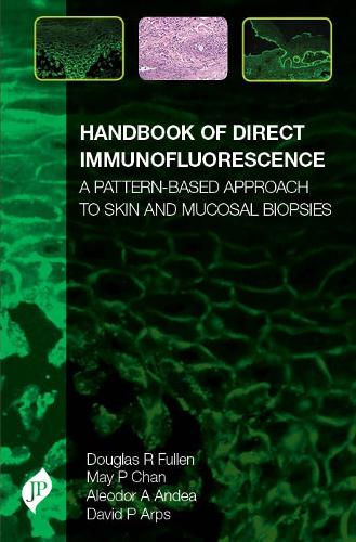 Паперова книга «Handbook of Direct Immunofluorescence: A Pattern-Based Approach to Skin and Mucosal Biopsies», авторів Алеодор А. Андеа, Девід П. Арпс, Дуглас Фуллен, Май П. Чан - фото №1