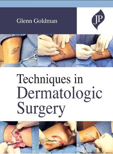 Паперова книга «Techniques in Dermatologic Surgery», автор Гленн Голдман - фото №1