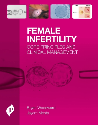 Бумажная книга «Female Infertility: Core Principles and Clinical Management», авторов Брайан Вудворд, Джаянт Мехта - фото №1