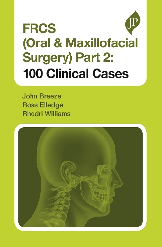 Paper book «FRCS (Oral & Maxillofacial Surgery) Part 2: 100 Clinical Cases», authors John Breeze, Rhodri Williams, Ross Elledge - фото №1