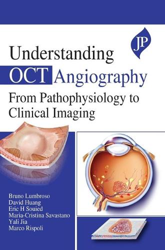 [object Object] «Understanding OCT Angiography: From Pathophysiology to Clinical Imaging», авторів Бруно Лумброзо, Крістіна Марія Савастано, Девід Хуанг, Ерік Х. Суїд, Марко Рісполі, Ялі Цзя - фото №1