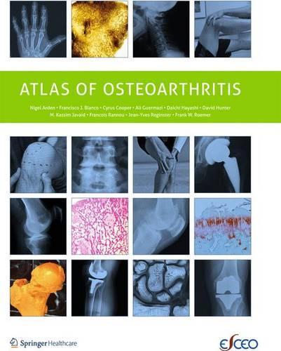 Бумажная книга «Atlas of Osteoarthritis», авторов Али Гермази, К. Купер, Даичи Хаяси, Франциско Бланко, Франсуа Ранну, Фрэнк Ромер, Жан-Ив Регинстер, М. Кассим Джавайд, Найджел Арден - фото №1