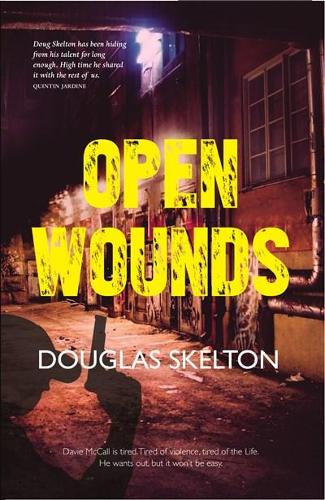Бумажная книга «Open Wounds», автор Дуглас Скелтон - фото №1