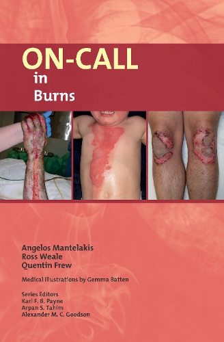 Бумажная книга «On-Call in Burns», авторов Ангелос Мантелакис, Квентин Фрю, Росс Уил - фото №1