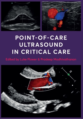 Бумажная книга «Point-of-Care Ultrasound in Critical Care» - фото №1