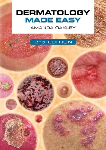 Бумажная книга «Dermatology Made Easy, second edition», автор Аманда Оукли - фото №1