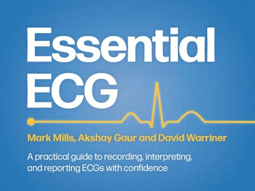 Паперова книга «Essential ECG: A practical guide to recording, interpreting, and reporting ECGs with confidence», авторів Акшай Ґаур, Девід Воррінер, Марк Міллз - фото №1
