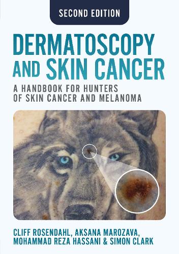 Бумажная книга «Dermatoscopy and Skin Cancer, second edition: A handbook for hunters of skin cancer and melanoma», авторов Аксана Марозава, Клифф Розендаль, Мохаммадреза Хассани, Саймон Кларк - фото №1