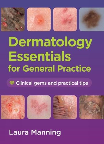 Паперова книга «Dermatology Essentials for General Practice: Clinical Gems and Practical Tips», автор Лаура Меннінг - фото №1