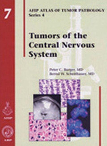 Паперова книга «Tumors of the Central Nervous System», авторів Бернд В. Шайтауер, Пітер К. Бургер - фото №1