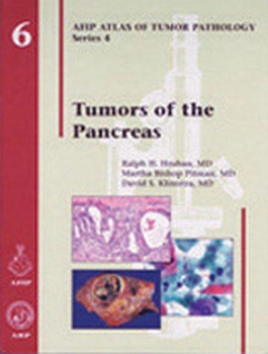 Паперова книга «Tumors of the Pancreas», авторів Девід С. Клімстра, Марта Бішоп Пітман, Ральф Х. Грубан - фото №1