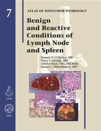 Паперова книга «Benign and Reactive Conditions of Lymph Node and Spleen», авторів Аттіліо Оразі, Денніс П. О'Меллі, Сюзан Л. Аббонданцо, Трейсі І. Джордж - фото №1
