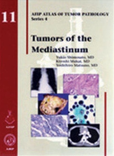 Бумажная книга «Tumors of the Mediastinum», авторов Киёси Мукаи, Йошихиро Мацуно, Юкио Шимосато - фото №1