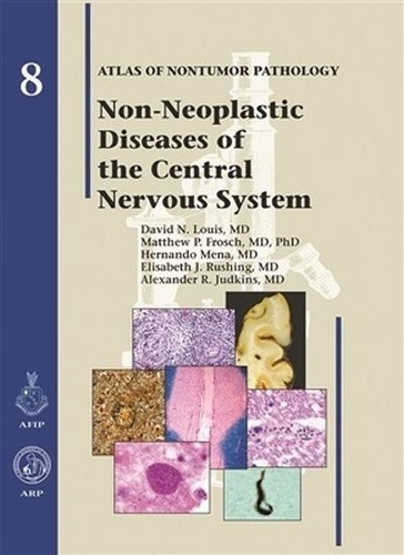 Бумажная книга «Non-Neoplastic Diseases of the Central Nervous System», авторов Александр Р. Джадкинс, Дэвид Н. Луис, Элизабет Дж. Рашинг, Эрнандо Мена, Мэтью П. Фрош - фото №1