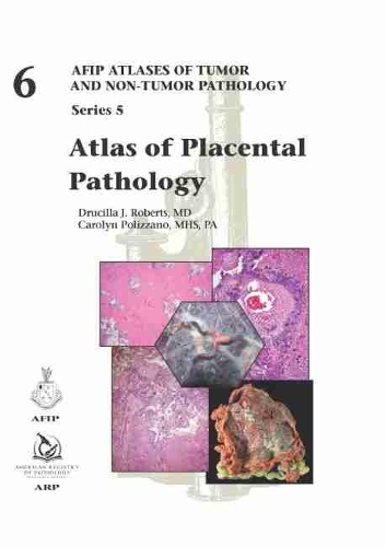 Бумажная книга «Atlas of Placental Pathology», авторов Каролин Полиццано, Друсилла Дж. Робертс - фото №1