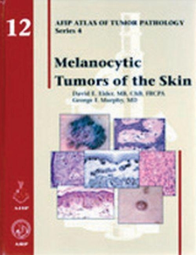 Паперова книга «Melanocytic Tumors of the Skin», авторів Девід Е. Елдер, Джордж Ф. Мерфі - фото №1