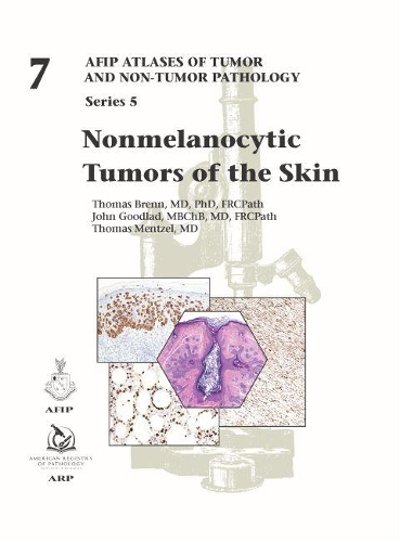 Паперова книга «Nonmelanocytic Tumors of the Skin», авторів Джон Гудлад, Томас Бренн, Томас Менцель - фото №1