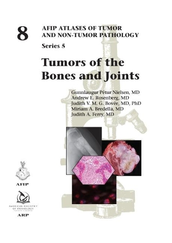 Бумажная книга «Tumors of the Bones and Joints», авторов Эндрю Э. Розенберг, Гуннлаугур Петур Нильсен, Джудит А. Ферри, Джудит В. М. Г. Бове, Мириам А. Бределла - фото №1
