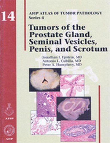 Бумажная книга «Tumors of the Prostate Gland, Seminal Vesicles, Penis, and Scrotum», авторов Джон Р. Сригли, Махул Б. Амин, Роберт Х. Янг - фото №1