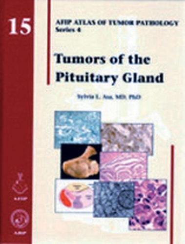 Паперова книга «Tumors of the Pituitary Gland», автор Сільвія Л. Аса - фото №1