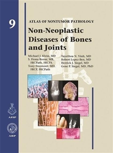 Бумажная книга «Non-Neoplastic Diseases of Bones and Joints», авторов Херрик Дж. Сигел, Майкл Дж. Клейн, Роберт Лопес-Бен, С. Фиона Бонар, Тони Фримонт, Туетоа Н. Винь - фото №1