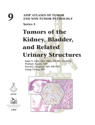 Бумажная книга «Tumors of the Kidney, Bladder, and Related Urinary Structures», авторов Дэвид Дж. Гриньон, Джон Эбл, Лян Чэн, Педрам Аргани - фото №1