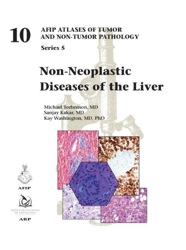 Бумажная книга «Non-Neoplastic Diseases of the Liver», авторов Кей Вашингтон, Майкл Торбенсон, Санджай Какар - фото №1