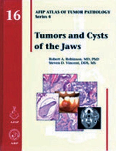 Паперова книга «Tumors and Cysts of the Jaws», авторів Роберт А. Робінсон, Стівен Д. Вінсент - фото №1