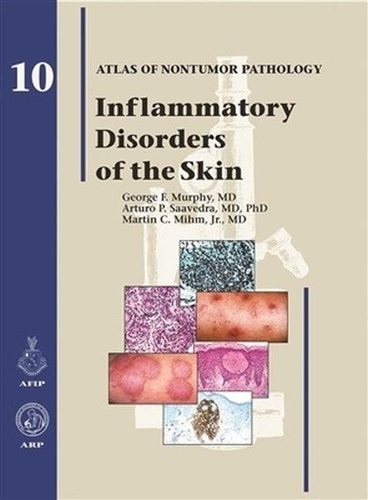 Бумажная книга «Inflammatory Disorders of the Skin», авторов Артуро П. Сааведра, Джордж Ф. Мерфи, Мартин К. Михм младший - фото №1
