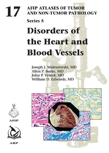 Бумажная книга «Disorders of the Heart and Blood Vessels», авторов Аллен П. Бёрк, Джон П. Вейнот, Джозеф Дж. Малешевски, Уильям Д. Эдвардс - фото №1