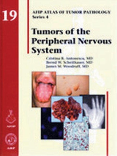 Паперова книга «Tumors of the Peripheral Nervous System», авторів Бернд В. Шайтауер, Крістіна Р. Антонеску, Джеймс М. Вудрафф - фото №1