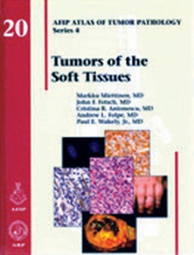 Паперова книга «Tumors of the Soft Tissues», авторів Ендрю Л. Фольпе, Крістіна Р. Антонеску, Джаованні Талліні, Джон Ф. Фетш, Маркку Міеттінен - фото №1