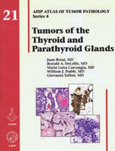 Паперова книга «Tumors of the Thyroid and Parathyroid Glands», авторів Джаованні Талліні, Хуан Росай, Марія Л. Карканджіу, Рональд А. ДеЛелліс, Вільям Дж. Фрейбл - фото №1