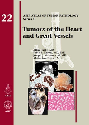 Бумажная книга «Tumors of the Heart and Great Vessels», авторов Алетта Энн Фрейзер, Аллен Берк, Фабио Р. Тавора, Джозеф Дж. Малешевски - фото №1