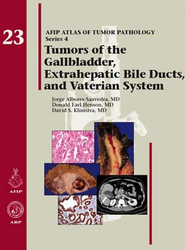 Паперова книга «Tumors of the Gallbladder, Extrahepatic Bile Ducts, and Vaterian System», авторів Девід С. Клімстра, Дональд Ерл Хенсон, Хорхе Альборес-Сааведра - фото №1
