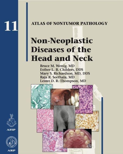 Бумажная книга «Non-Neoplastic Diseases of the Head and Neck», авторов Брюс М. Вениг, Эстер Л. Б. Чилдерс, Лестер Д. Р. Томпсон, Мэри С. Ричардсон, Раджа Р. Ситхала - фото №1