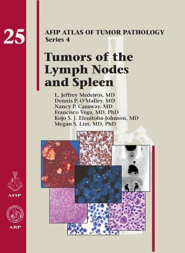 Бумажная книга «Tumors of the Lymph Nodes and Spleen», авторов Деннис П. О'Мэлли, Франциско Вега, Коджо С. Дж. Эленитоба-Джонсон, Л. Джеффри Медейрос, Меган С. Лим, Нэнси П. Карауэй - фото №1
