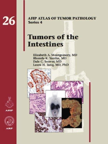 Бумажная книга «Tumors of the Intestines», авторов Дейл К. Сновер, Элизабет А. Монтгомери, Лаура Х. Танг, Ронда К. Янтисс - фото №1