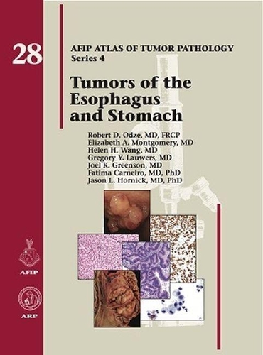 Паперова книга «Tumors of the Esophagus and Stomach», авторів Елізабет А. Монтгомері, Фатіма Карнейро, Грегорі Ю. Лауверс, Хелен Х. Ванг, Джейсон Л. Хорнік, Джоел К. Грінсон, Роберт Д. Одзе - фото №1