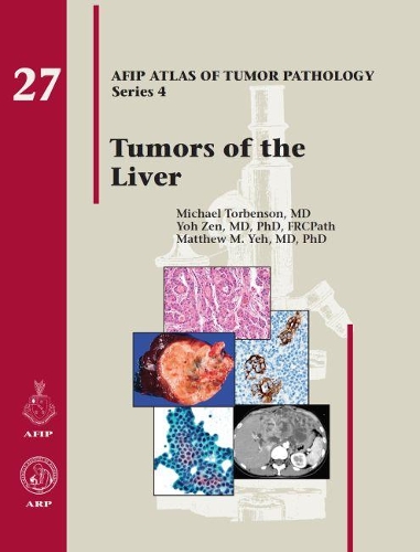 Бумажная книга «Tumors of the Liver», авторов Мэтью М. Йех, Майкл Торбенсон, Йох Дзен - фото №1