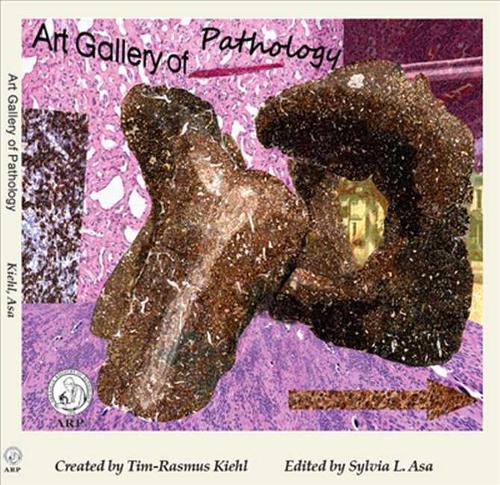 Паперова книга «Art Gallery of Pathology», авторів Сільвія Аса, Тім-Расмус Кіль - фото №1