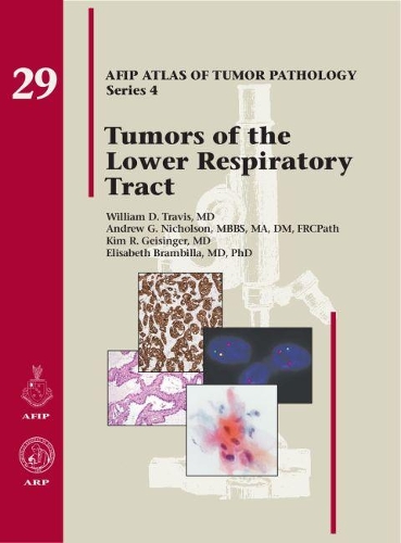 Паперова книга «Tumors of the Lower Respiratory Tract», авторів Ендрю Г. Ніколсон, Елізабет Брамбілла, Кім Р. Гайзінгер, Вільям Д. Тревіс - фото №1