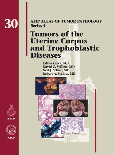 Бумажная книга «Tumors of the Uterine Corpus and Trophoblastic Diseases», авторов Дэвид К. Уилбур, Эстер Олива, Нил Дж. Себир, Роберт А. Сослоу - фото №1