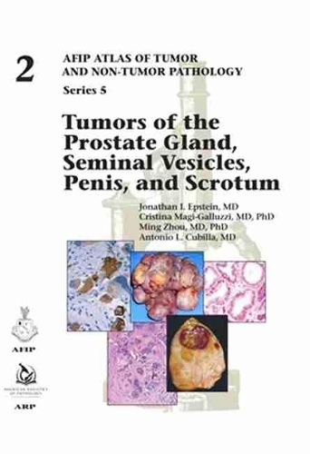 Бумажная книга «Tumors of the Prostate Gland, Seminal Vesicles, Penis, and Scrotum», авторов Антонио Л. Кубилья, Кристина Маги-Галлуцци, Джонатан И. Эпштейн, Минг Чжоу - фото №1